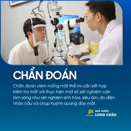 Viêm mống mắt thể mi 5