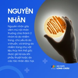 Viêm mủ nội nhãn 3