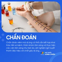 Viêm mũi dị ứng 5
