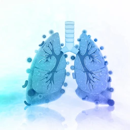 Viêm phổi cộng đồng 1