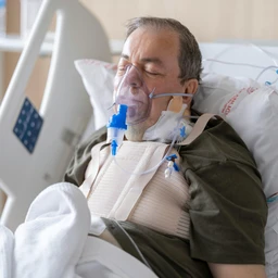 Viêm phổi cộng đồng 3