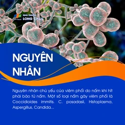 Viêm phổi do nấm 3