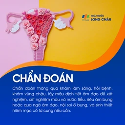 Viêm phụ khoa 5