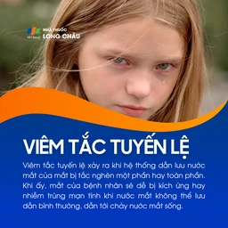 Viêm tắc tuyến lệ 1