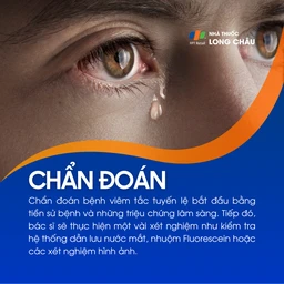 Viêm tắc tuyến lệ 5