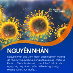 Viêm thanh quản 3