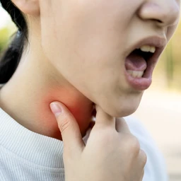 Viêm thanh quản cấp là gì? Những vấn đề cần biết về viêm thanh quản cấp 2