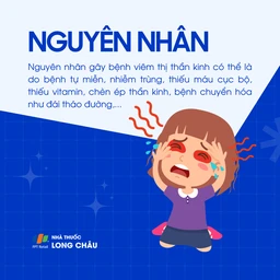 Viêm thị thần kinh 3