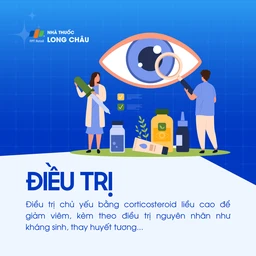 Viêm thị thần kinh 6