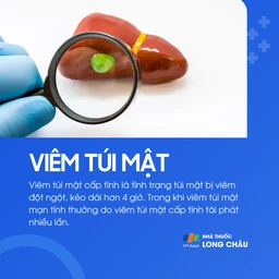 Viêm túi mật 2