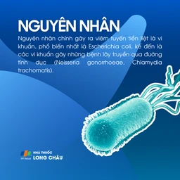 Viêm tuyến tiền liệt 3