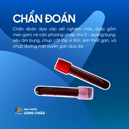 Viêm xơ đường mật 5