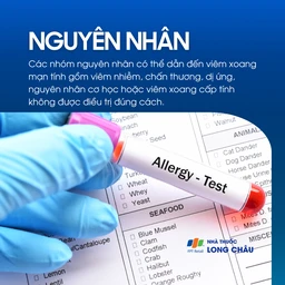 Viêm xoang mạn tính 3