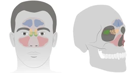 Viêm xoang sàng sau là gì? Những vấn đề cần biết về viêm xoang sàng sau 2