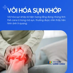 Vôi hóa sụn khớp 1