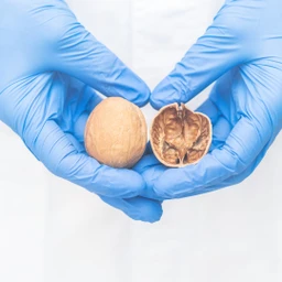 Vôi hóa tinh hoàn 1