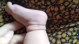 Vòng thắt chi bẩm sinh 1