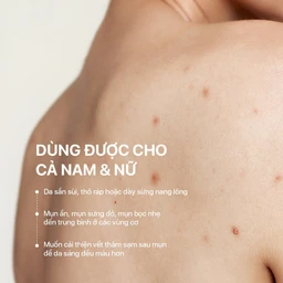 Xịt giảm mụn lưng Neo Acnes làm dịu nốt mụn, giảm tình trạng mụn trên da cơ thể (100ml) 3