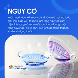 Xuất huyết dưới kết mạc 4