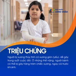 Xương thủy tinh 2