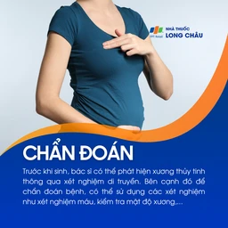 Xương thủy tinh 5