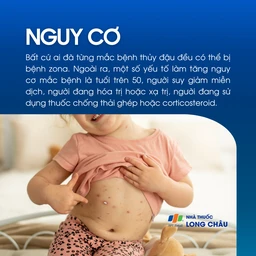 Nguy cơ mắc bệnh zona thần kinh ở người từng bị thủy đậu