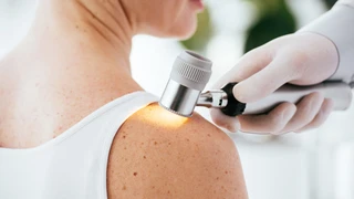 Dày sừng nang lông là gì? Nguyên nhân, triệu chứng và cách điều trị