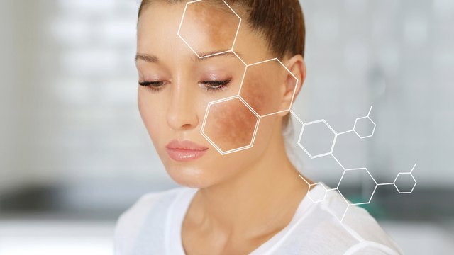 bai-viet/retinol-tri-nam-tan-nhang-co-hieu-qua-khong-giai-ma-cong-dung-tu-a-z.html