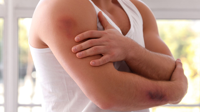 bai-viet/5-dau-hieu-tren-da-canh-bao-benh-gan-ban-khong-nen-bo-qua.html