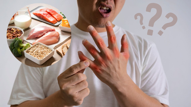 bai-viet/an-uong-rat-healthy-nhung-axit-uric-van-tang-vi-sao.html