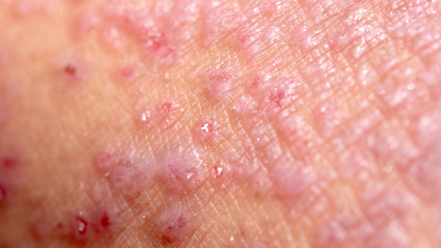 bai-viet/cham-sinh-duc-kham-o-dau-tot-goi-y-dia-diem-uy-tin.html