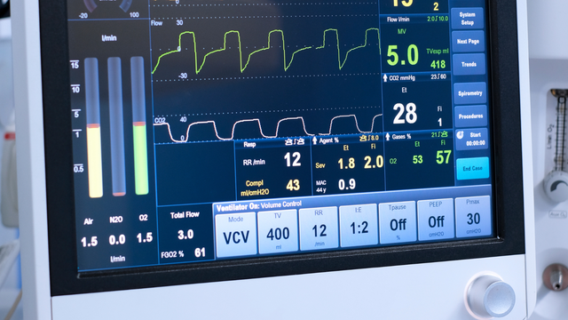 bai-viet/chi-so-peep-trong-may-tho-la-gi-va-y-nghia-cua-con-so-nay.html