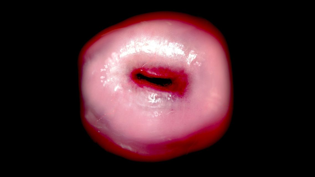 bai-viet/co-tu-cung-lang-la-gi-hieu-dung-de-cham-soc-suc-khoe-phu-khoa.html