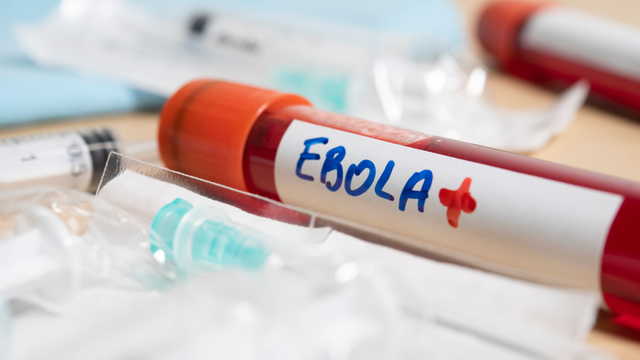 bai-viet/dien-bien-hien-tai-cua-dich-ebola-tai-chau-phi.html