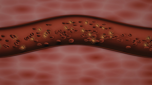 bai-viet/cach-giam-mo-mau-cao-khong-dung-thuoc-theo-tu-van-cua-bac-si-bv-bach-mai.html