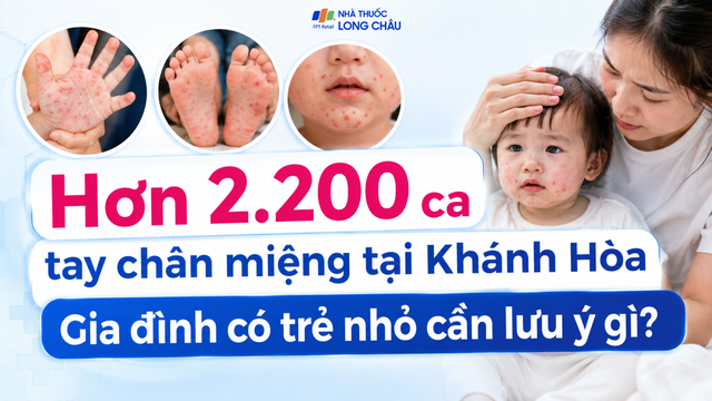 bai-viet/hon-2-200-ca-tay-chan-mieng-tai-khanh-hoa-gia-dinh-co-tre-nho-can-luu-y-gi-10009.html