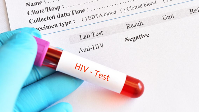 bai-viet/ket-qua-xet-nghiem-hiv-am-tinh-da-chac-chan-khong-nhiem-hiv-chua.html