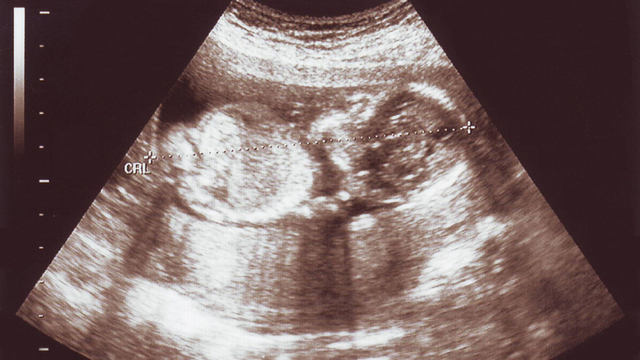 bai-viet/khi-thai-16-tuan-nang-bao-nhieu-gam-su-phat-trien-cua-thai-nhi-16-tuan-nhu-the-nao.html