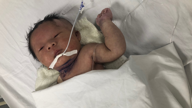 bai-viet/sang-loc-roi-loan-chuyen-hoa-bam-sinh-bang-msms-la-gi.html