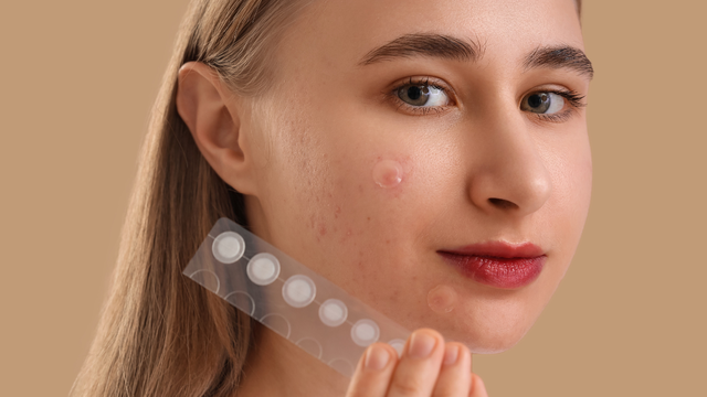 bai-viet/sau-khi-nan-mun-co-nen-dung-mieng-dan-mun-giai-dap-chi-tiet.html