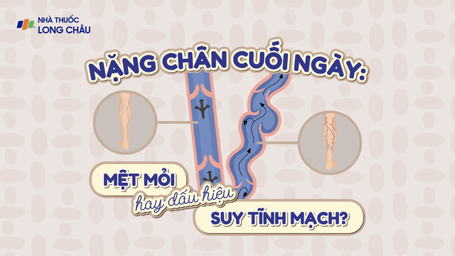 bai-viet/infographic-nang-chan-cuoi-ngay-met-moi-hay-dau-hieu-suy-tinh-mach.html