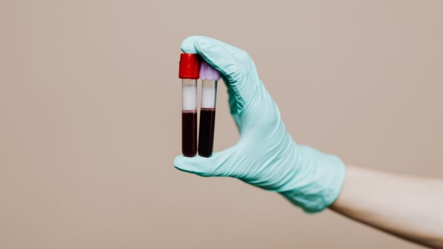 bai-viet/tim-hieu-xet-nghiem-bat-dung-nap-lactose-o-tre-so-sinh.html