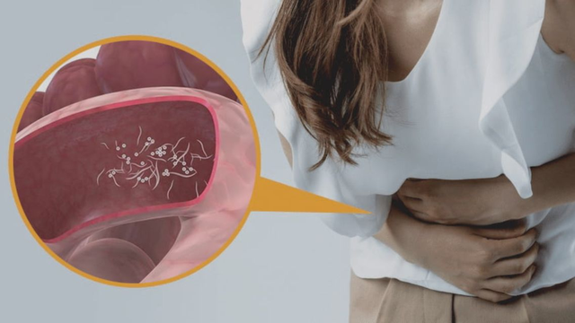 bai-viet/xet-nghiem-ky-sinh-trung-co-can-nhin-an-khong-va-can-luu-y-gi.html