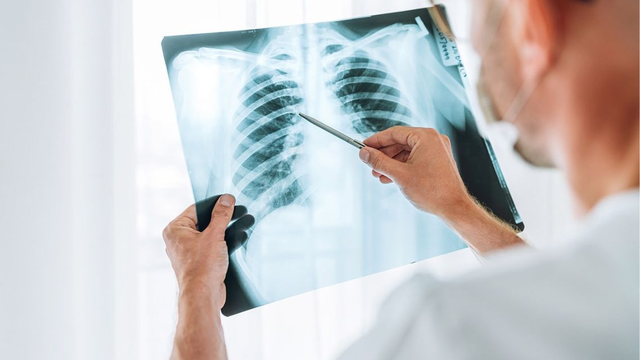 bai-viet/xet-nghiem-lao-phoi-bao-lau-co-ket-qua-phu-thuoc-yeu-to-nao.html