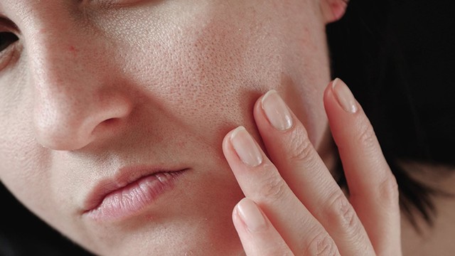 bai-viet/10-nguyen-nhan-khien-da-kho-mat-di-do-am-ai-cung-tung-mac-phai.html