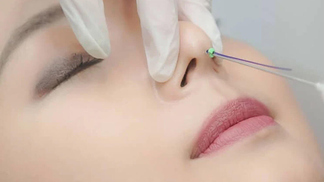 bai-viet/16-tuoi-nang-mui-duoc-khong-nhung-dieu-can-luu-y-truoc-khi-quyet-dinh-nang-mui.html