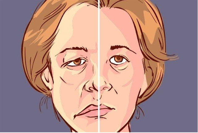 benh/liet-nua-nguoi-17.html