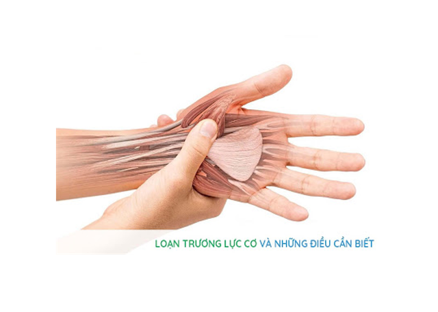 benh/loan-truong-luc-co-20.html