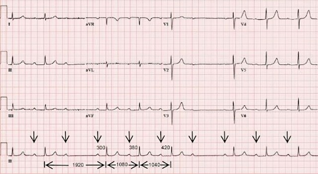 benh/block-nhi-that-224.html