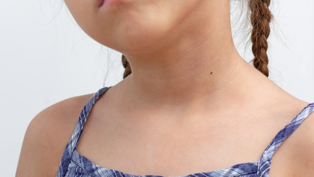 benh/teo-thuc-quan-248.html